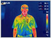 thermography