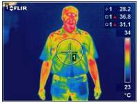 thermography